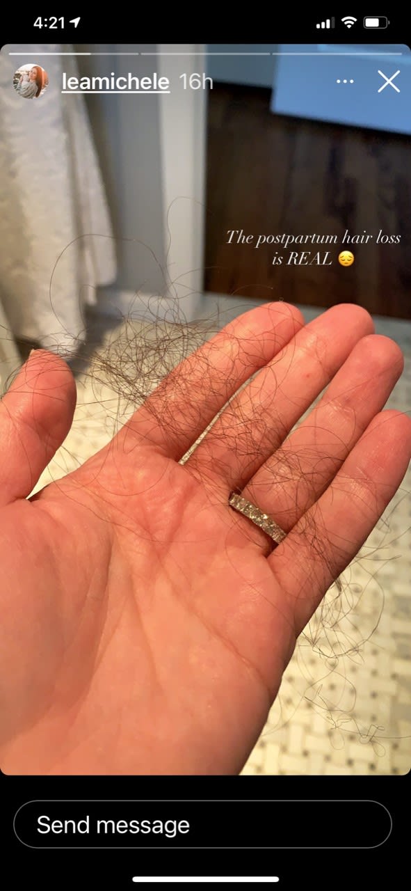 lea michele s hair loss ig stories 2 data
